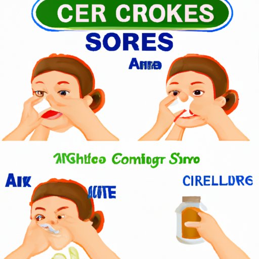 III. Home remedies for canker sores