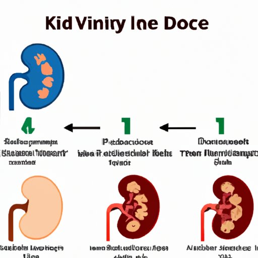 V. Preventing Kidney Disease Progression: A Guide to the Stages of Kidney Disease