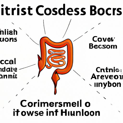 Understanding Colitis Symptoms A Comprehensive Guide The Riddle Review