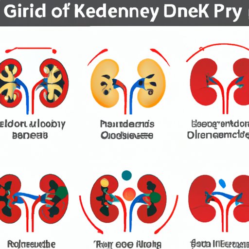 Understanding Stage 3 Kidney Disease Causes, Symptoms, Treatments, and Coping Strategies The