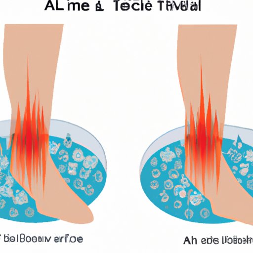 How to Cure Achilles Tendonitis Fast Effective Home Remedies