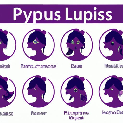 The Many Faces of Lupus: Recognizing Its Varied Symptoms