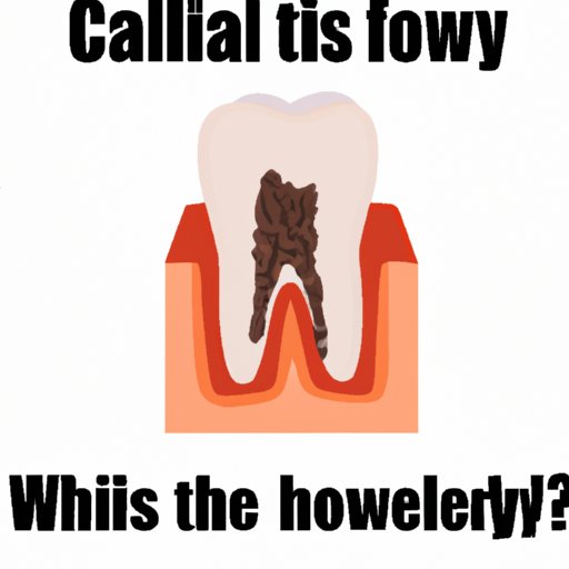 How Do You Know If You Have A Cavity Signs Prevention And Treatment how-do-you-know-if-you-have-a-cavity-signs-prevention-and-treatment
