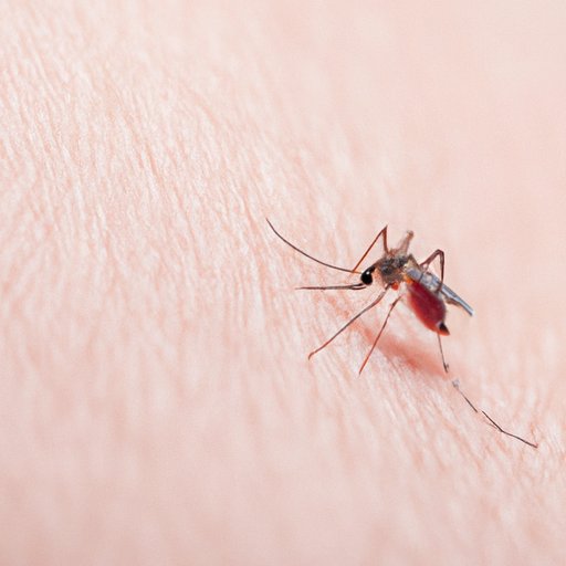Can You Be Allergic to Mosquito Bites? Exploring the Truth Behind the