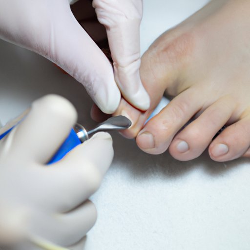 How to Get Rid of Ingrown Toenails A Comprehensive Guide The Riddle
