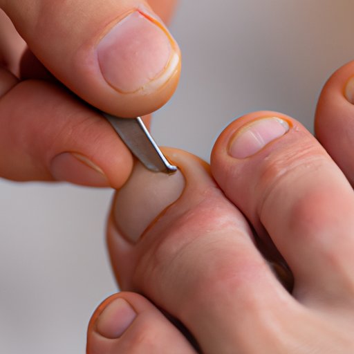 How to Remove Ingrown Toenail Safely at Home A StepbyStep Guide