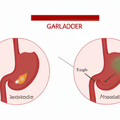 10 Common Symptoms of Gallbladder Problems You Need to Look Out For