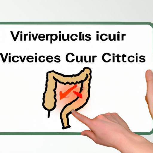 Recognizing Diverticulitis A Comprehensive Guide to Symptoms The Riddle Review