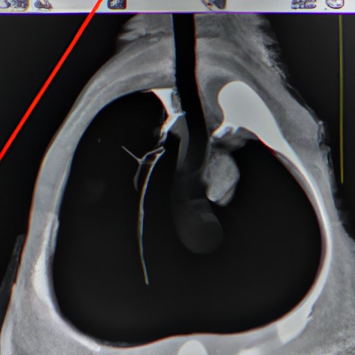 What Does a Nuclear Stress Test Show Understanding and Decoding the