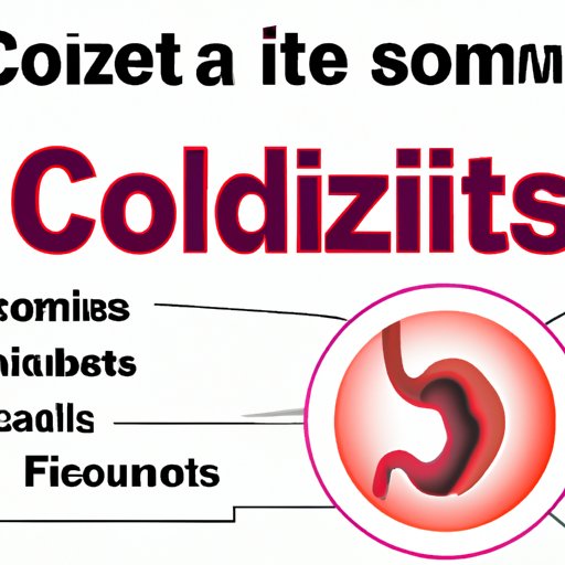 Understanding Colitis Symptoms A Comprehensive Guide The Riddle Review